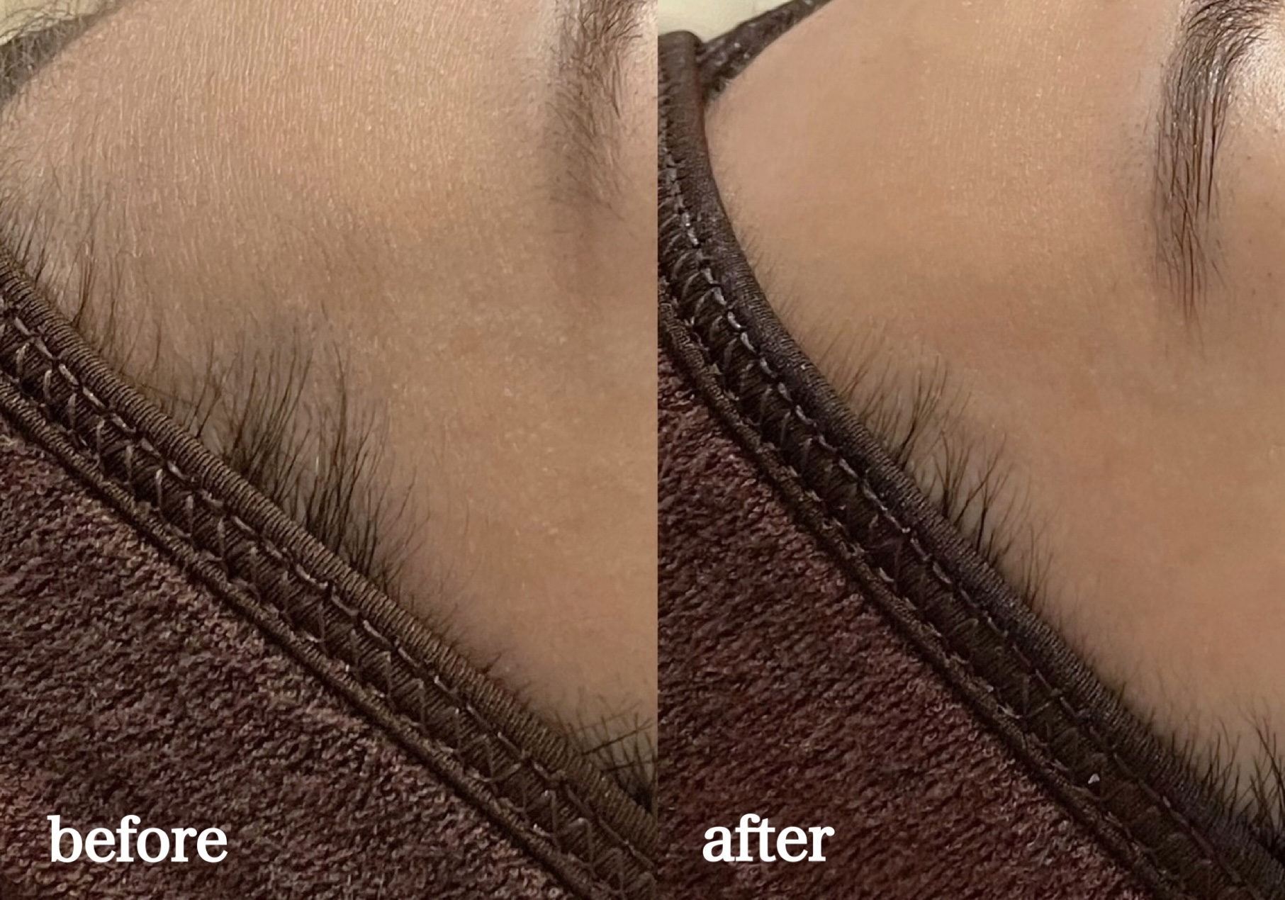 フェイシャルワックスは毛を取るだけ？と思っていませんか。